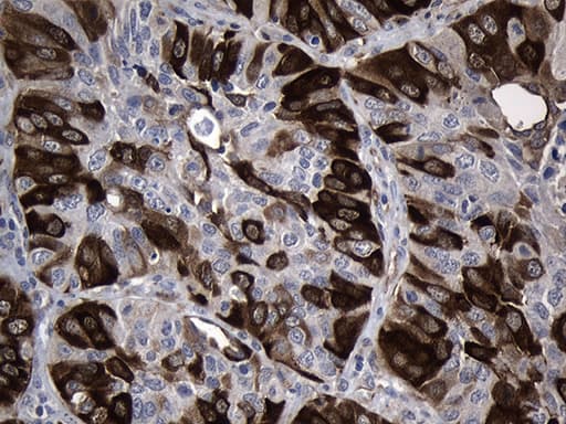 RRM2 Antibody (clone OTI3D3)