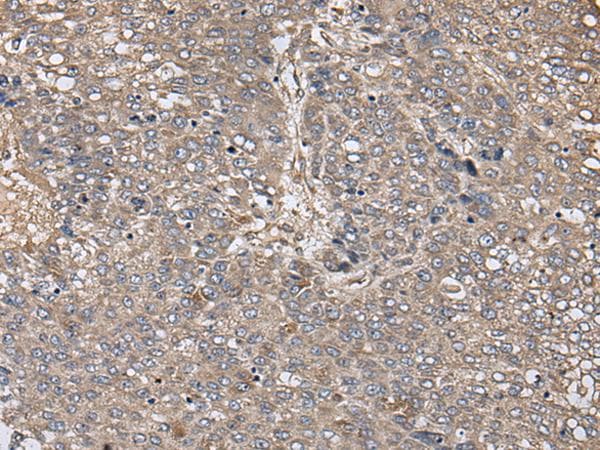 ZFP36 / Tristetraprolin Antibody