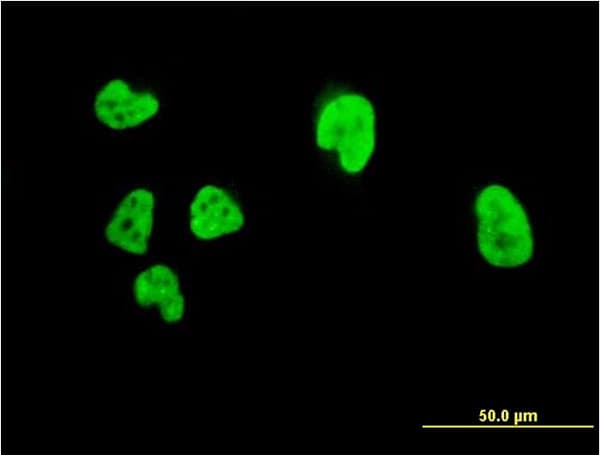 IHC-plus™ CBFA1 / RUNX2 Antibody (clone 3F5)