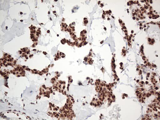 EWSR1 / EWS Antibody (aa256-447, clone OTI2B3, Carrier-free)