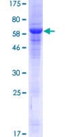 Human ANTXR1 / TEM8 Protein (Recombinant GST)