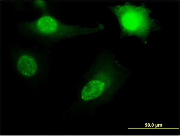 RPL11 / Ribosomal Protein L11 Antibody (clone 2A1)