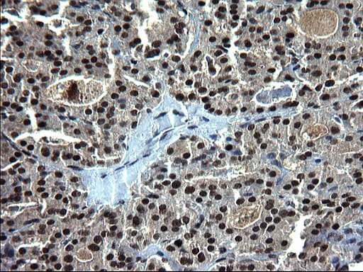 RPRD1B Antibody (clone OTI1C9)