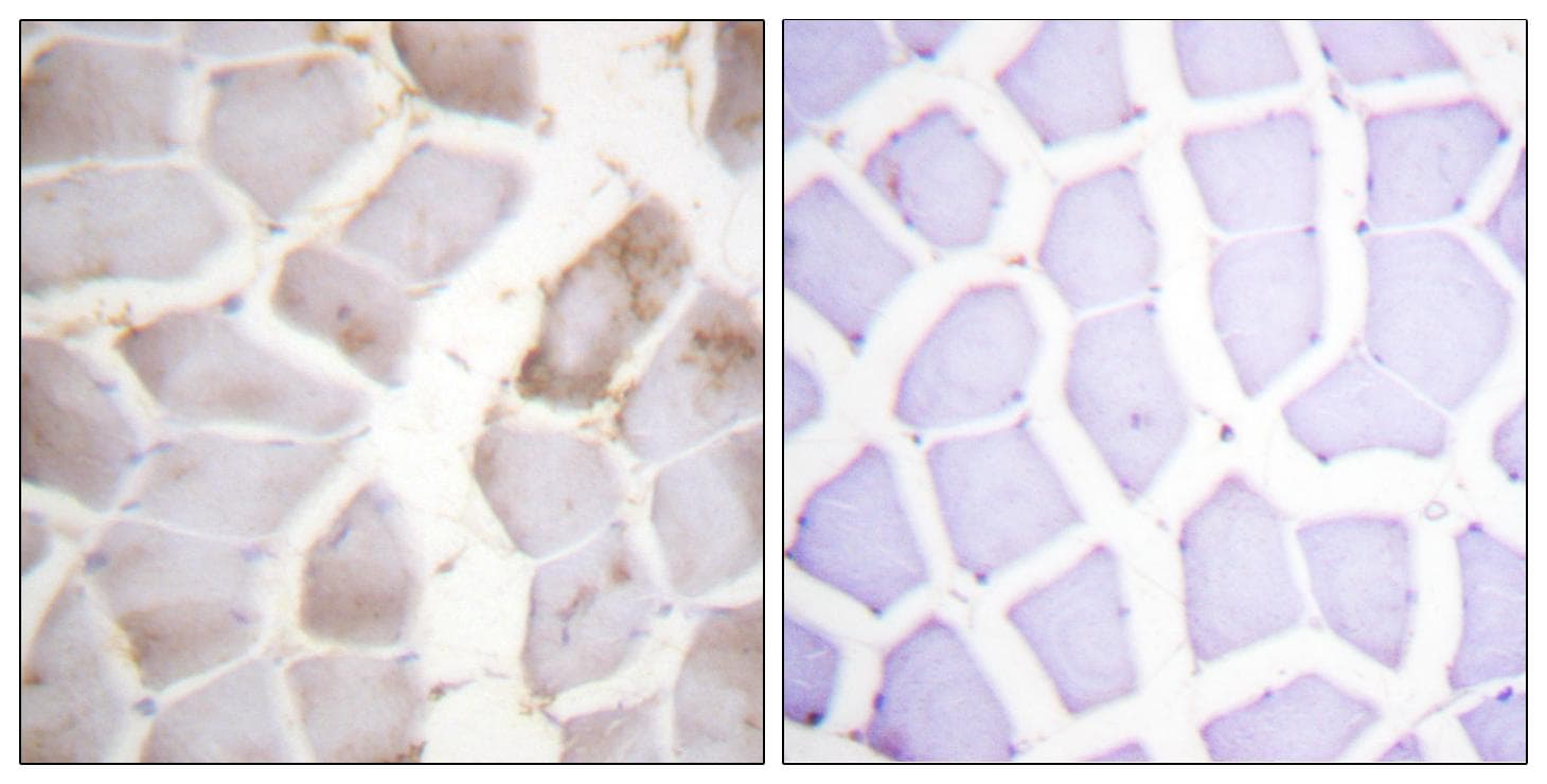 PRKAB1 / AMPK Beta 1 Antibody (phospho-Ser181)