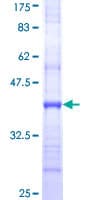 Human SLC15A1 / PEPT1 Protein (Recombinant GST, N-terminus)