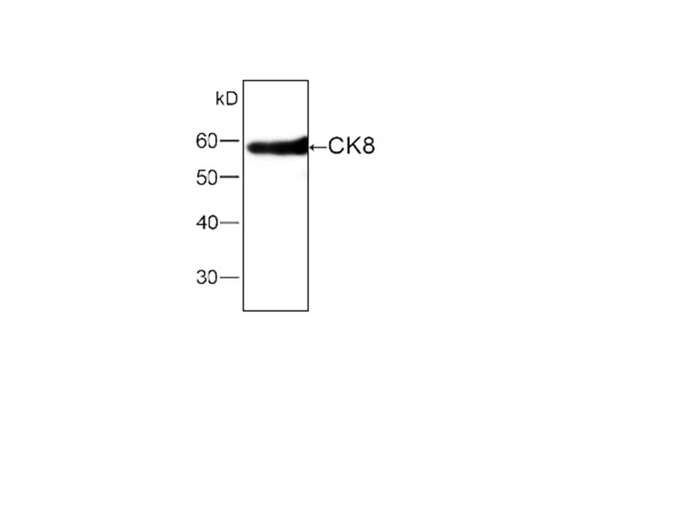 Monoclonal Mouse anti-Human KRT8 / CK8 / Cytokeratin 8 Antibody (IHC, WB)