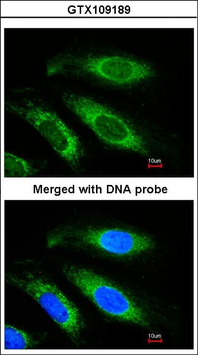 ETFB Antibody (aa1-255)