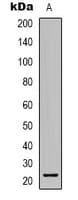 TCEAL6 Antibody (Internal)