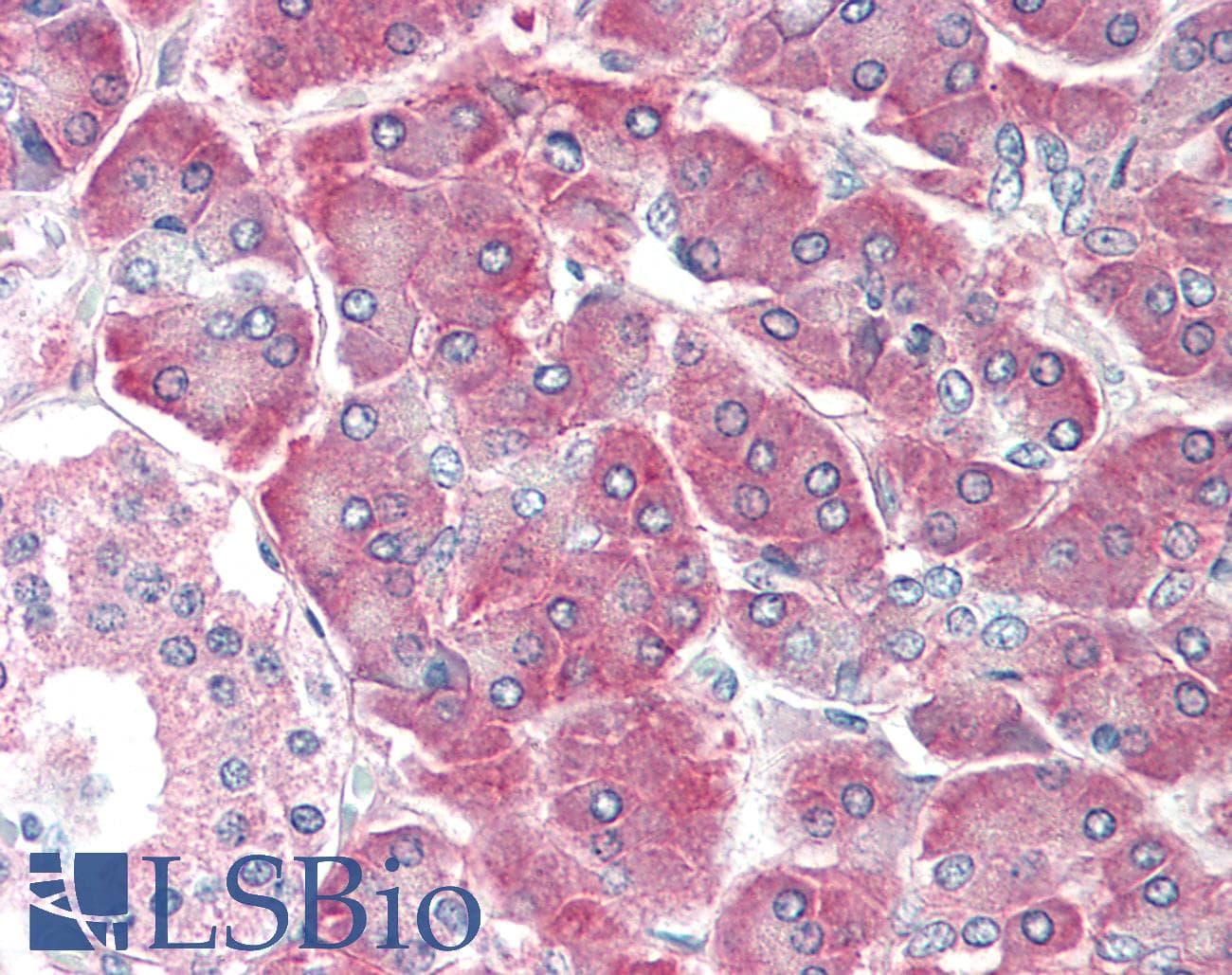 IHC-plus™ AIMP1 / EMAP II Antibody (aa137-149)