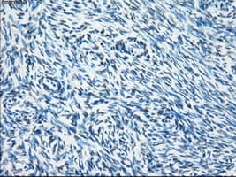 SORD / Sorbitol Dehydrogenase Antibody (clone OTI12A7)