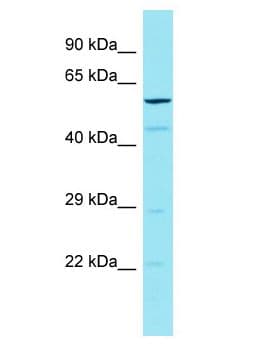 CCDC79 Antibody (aa498-547)