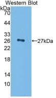 CFH / Complement Factor H Antibody (clone C1)