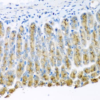UQCR10 / UCRC Antibody