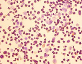 Polyclonal Rabbit anti-Human HOMER1 / Homer 1 Antibody (IHC, WB)