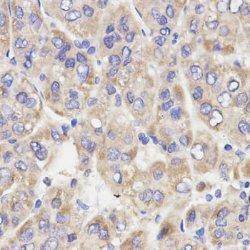 GRM3 / MGLUR3 Antibody