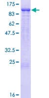Human KLHL1 Protein (Recombinant GST)