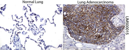 CTNNB1 / Beta Catenin Antibody (clone UMAB15)