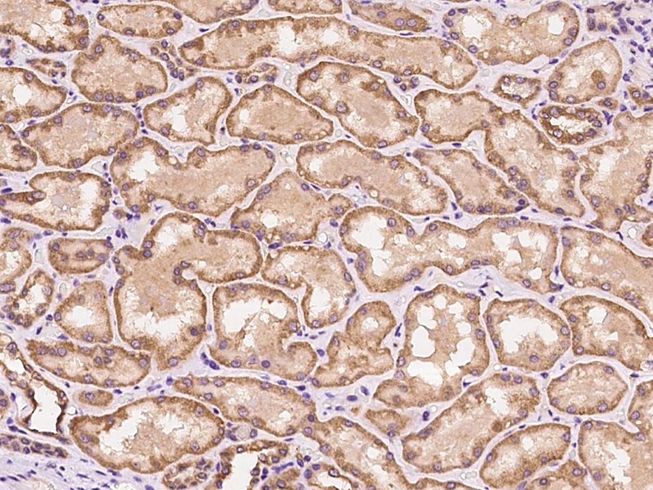 CSNK1G2 / CKI-Gamma 2 Antibody (Preservative Free)