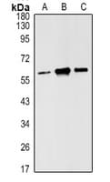 ESR2 / ER Beta Antibody