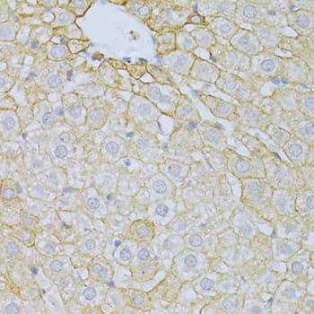 PLA2R / PLA2R1 Antibody