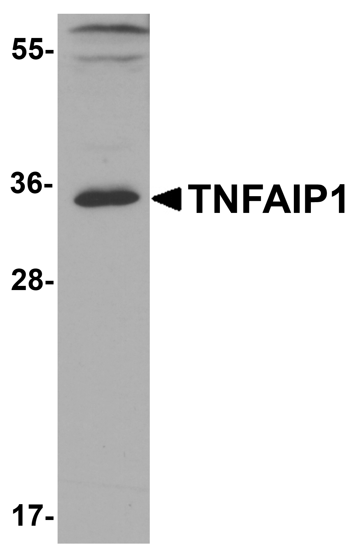 IHC-plus™ Polyclonal Rabbit anti-Human TNFAIP1 Antibody (IHC, IF, WB)