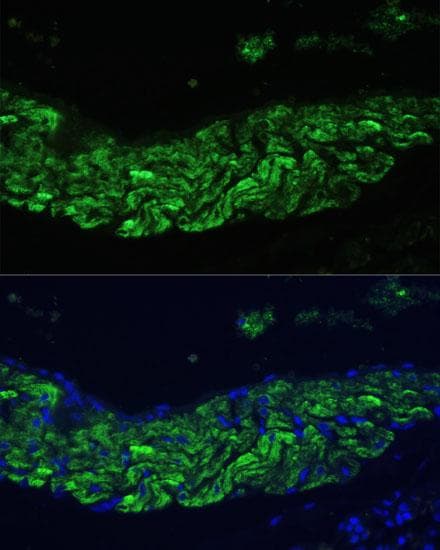ALOX12 / 12 Lipoxygenase Antibody