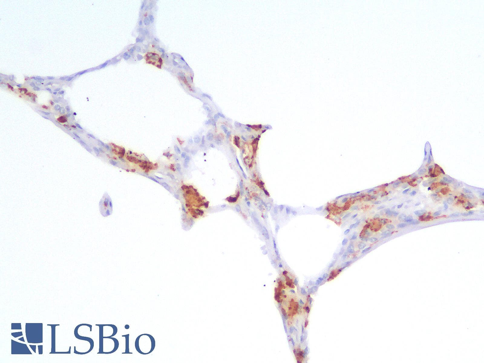 PathPlus™ Recombinant Monoclonal Rabbit anti-Human CD68 Antibody (clone C68/2908R, IHC, WB)