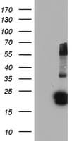 FGF21 Antibody (clone OTI2F10)