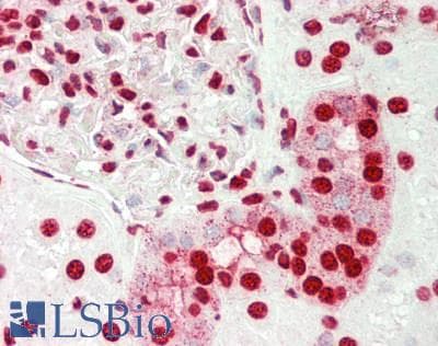 SMARCE1 / BAF57 Antibody (aa39-88)