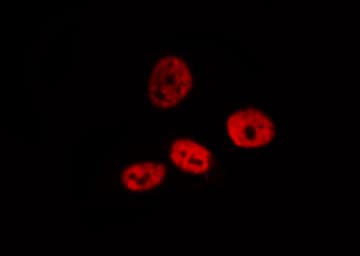 PRPF31 Antibody
