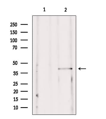 SSTR2 Antibody