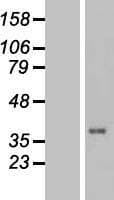 TUSC3 Protein (Over-Expression Lysate Myc-DDK (Flag))