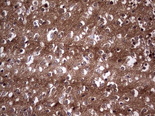 TACC2 Antibody (aa727-1026, clone OTI4F10, Carrier-free)