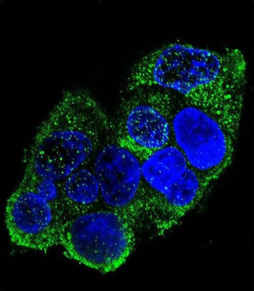 IHC-plus™ Polyclonal Rabbit anti-Human COL8A2 / Collagen VIII Antibody (aa571-599, IHC, IF, WB)