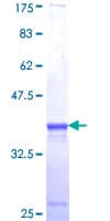 Human MACF1 Protein (Recombinant GST, N-terminus)