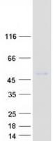 Human CHIT1 / Chitotriosidase Protein (Recombinant Myc-DDK (Flag))