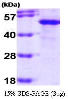 Human ST13 Protein (Recombinant)