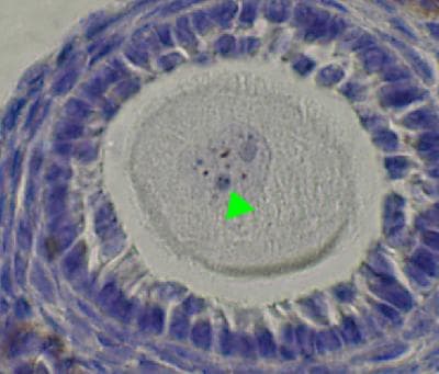 SYCP3 / SCP3 Antibody (C-Terminus)