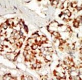 KSR1 Antibody (aa1-30)