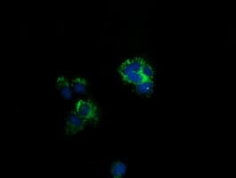 CLPP Antibody (clone OTI1D3)