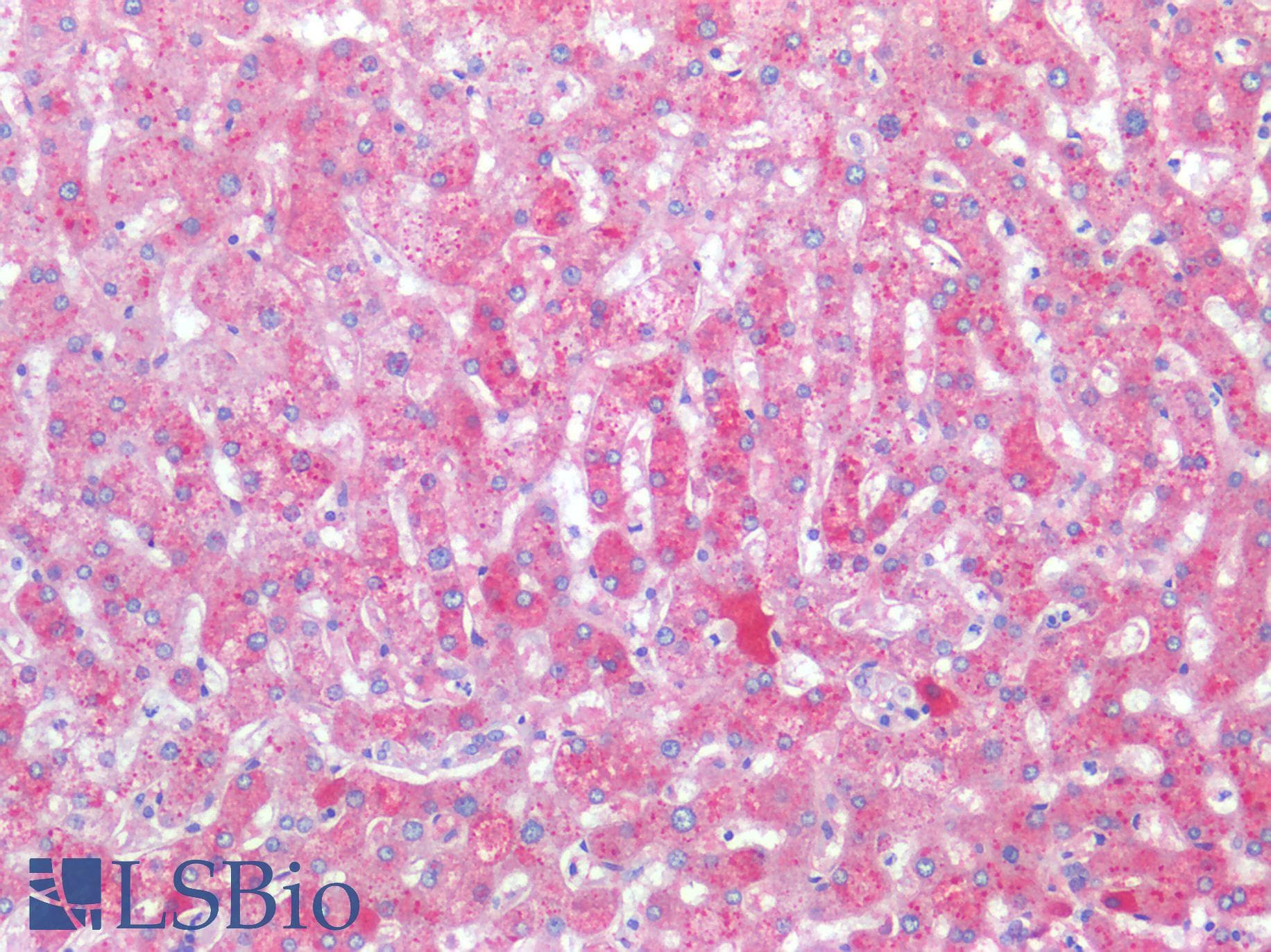 PathPlus™ Monoclonal Mouse anti-Human APCS / Serum Amyloid P / SAP Antibody (clone 7F3, IHC, WB)