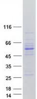 Human UBA3 / UBE1C Protein (Recombinant Myc-DDK (Flag))