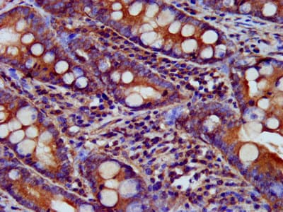 USP24 Antibody