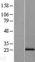 NAT5 / NAA20 Protein (Over-Expression Lysate Myc-DDK (Flag))