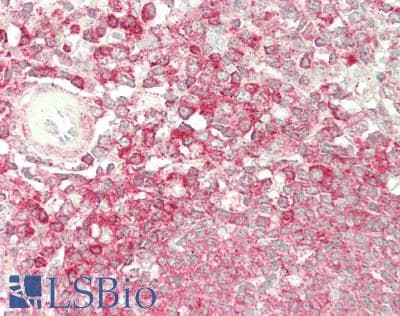 IHC-plus™ Polyclonal Rabbit anti-Human DIAPH1 Antibody (aa1-50, IHC, WB)