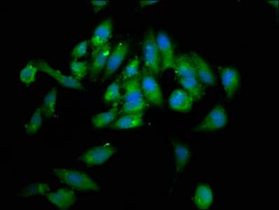 Polyclonal Rabbit anti-Human WHSC1 / NSD2 Antibody (IHC, IF)