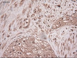 NTF3 / Neurotrophin 3 Antibody (clone OTI5C7)