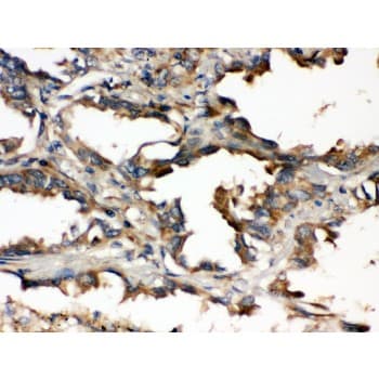 UBE2Q2 Antibody (aa83-123)