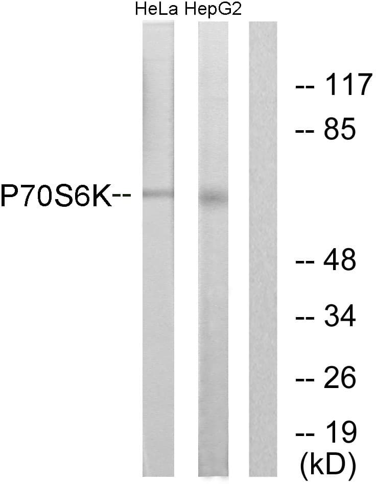 IHC-plus™ RPS6KB1 / P70S6K / S6K Antibody (aa337-386)