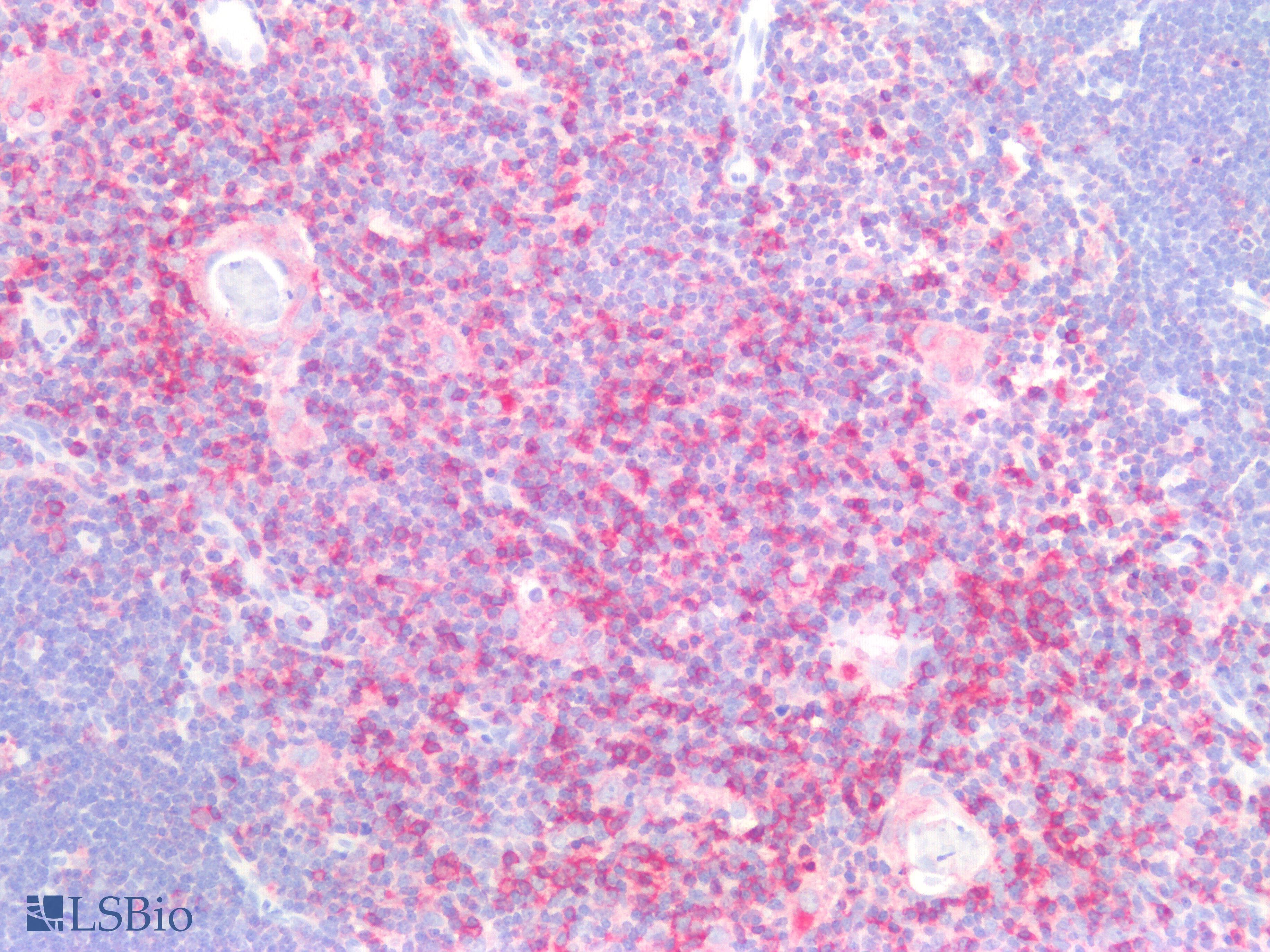IHC-plus™ CD45R Antibody (Concentrated)